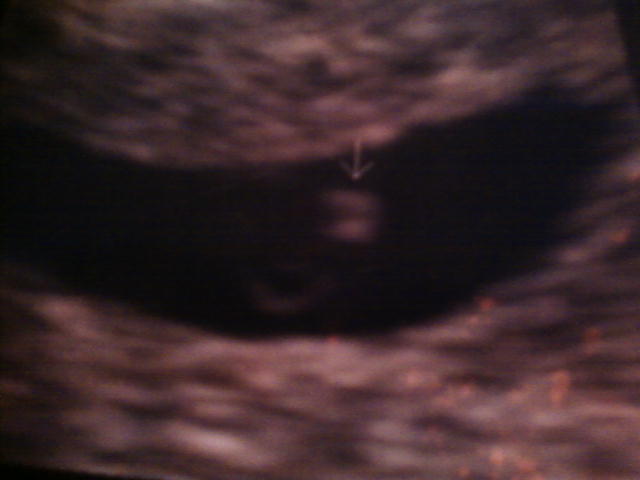 there you are 5  weeks and 6days when mommy found out i was pregnant 08/29/09